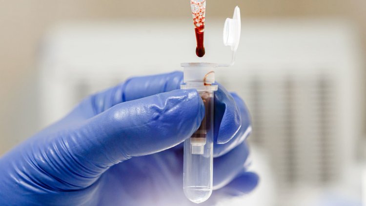 Lab-grown blood given to humans in world-first trial aimed at combatting rare disorders